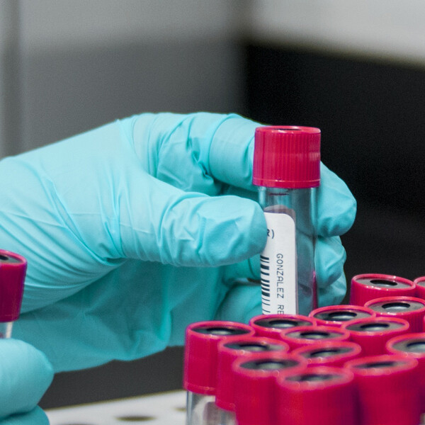 trial vials